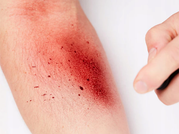 Spray Artificiale di Sangue Halloween